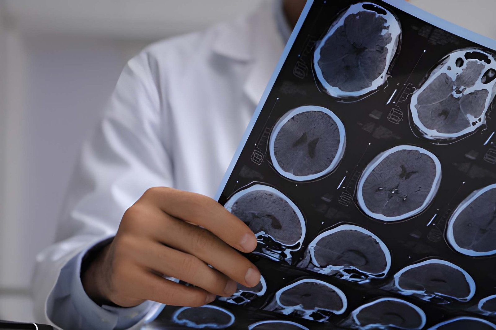 Valor del Acuerdo por Síndrome Postconmoción Cerebral